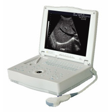 Scanner de ultrassom profissional para laptop médico (THR-LT001)